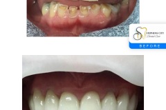 IMG_0003-Before-After