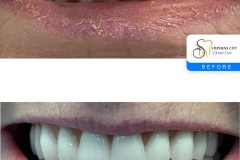 IMG_3403-Before-After