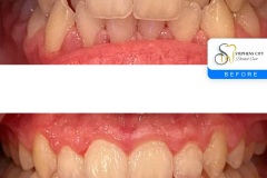 IMG_3483-Before-After