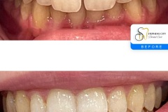 IMG_3486-Before-After