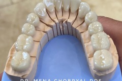 Stephens City Dental Care