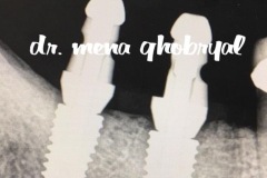 Stephens City Dental Care